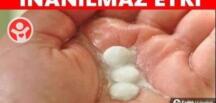 A’spirini eritip bacaklarınıza sürerseniz Ba’kınız ne oluyor..