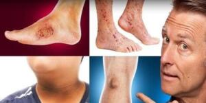 Cildinizdeki bu değişimler insülin direncinizin habercisi olabilir!